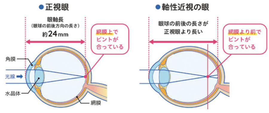 リジュセアミニ点眼液